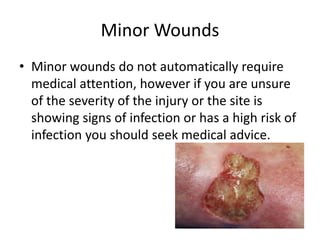 Minor Wounds
• Minor wounds do not automatically require
medical attention, however if you are unsure
of the severity of the injury or the site is
showing signs of infection or has a high risk of
infection you should seek medical advice.
 