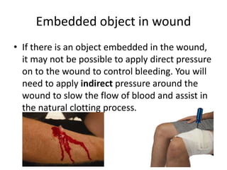 Embedded object in wound
• If there is an object embedded in the wound,
it may not be possible to apply direct pressure
on to the wound to control bleeding. You will
need to apply indirect pressure around the
wound to slow the flow of blood and assist in
the natural clotting process.
 