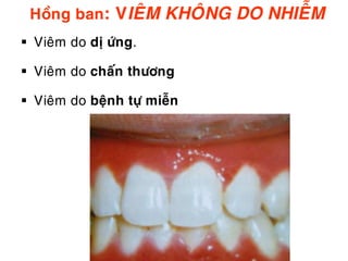 Hoàng ban: VIEÂM KHOÂNG DO NHIEÃM
 Vieâm do dò öùng.

 Vieâm do chaán thöông

 Vieâm do beänh töï mieãn
 