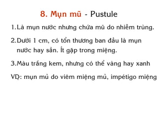 8. Muïn muõ - Pustule
1.Laø muïn nöôùc nhöng chöùa muõ do nhieãm truøng.

2.Döôùi 1 cm, coù toån thöông ban ñaàu laø muïn
  nöôùc hay saàn. Ít gaëp trong mieäng.

3.Maøu traéng kem, nhöng coù theå vaøng hay xanh

VDï: muïn muû do vieâm mieäng muû, impeùtigo mieäng
 