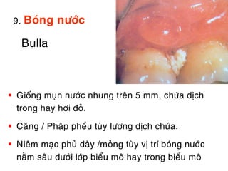 9. Boùng    nöôùc

   Bulla



 Gioáng muïn nöôùc nhöng treân 5 mm, chöùa dòch
  trong hay hôi ñoû.

 Caêêng / Phaäp pheàu tuøy löông dòch chöùa.

 Nieâm maïc phuû daøy /moûng tuøy vò trí boùng nöôùc
  naèm saâu döôùi lôùp bieåu moâ hay trong bieåu moâ
 