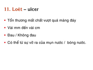 11. Loeùt – ulcer

 Toån thöông maát chaát vöôït quaù maøng ñaùy

 Vaøi mm ñeán vaøi cm

 Ñau / Khoâng ñau

 Coù theå töø söï vôõ ra cuûa muïn nöôùc / boùng nöôùc.
 