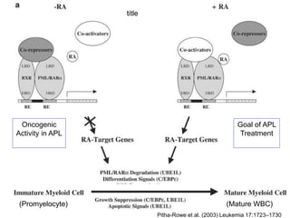 Oncogenic
Activity in APL
Goal of APL
Treatment
title
(Promyelocyte) (Mature WBC)
Pitha-Rowe et al. (2003) Leukemia 17:1723–1730
 