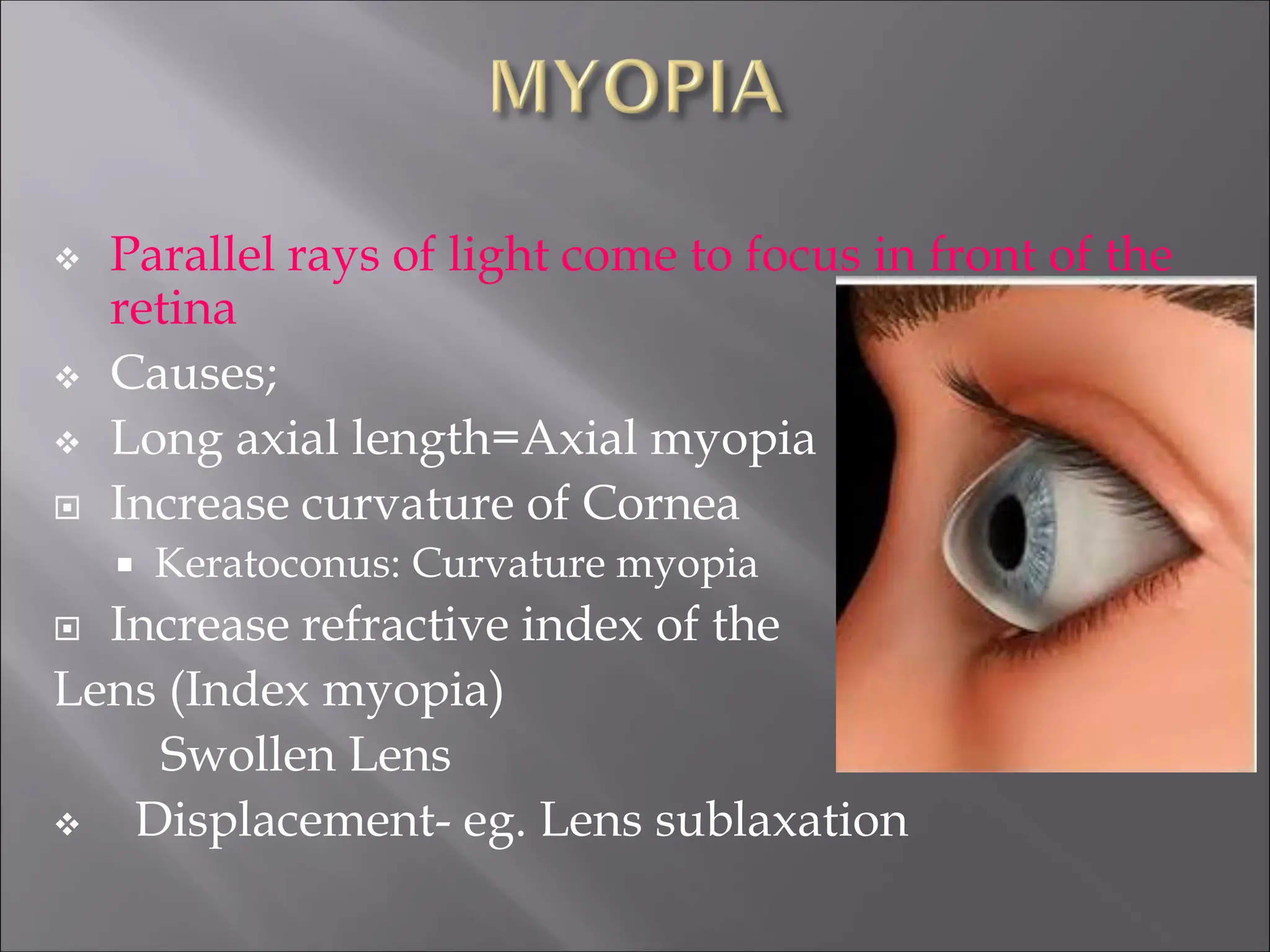  Parallel rays of light come to focus in front of the
retina
 Causes;
 Long axial length=Axial myopia
 Increase curvature of Cornea
 Keratoconus: Curvature myopia
 Increase refractive index of the
Lens (Index myopia)
Swollen Lens
 Displacement- eg. Lens sublaxation
 