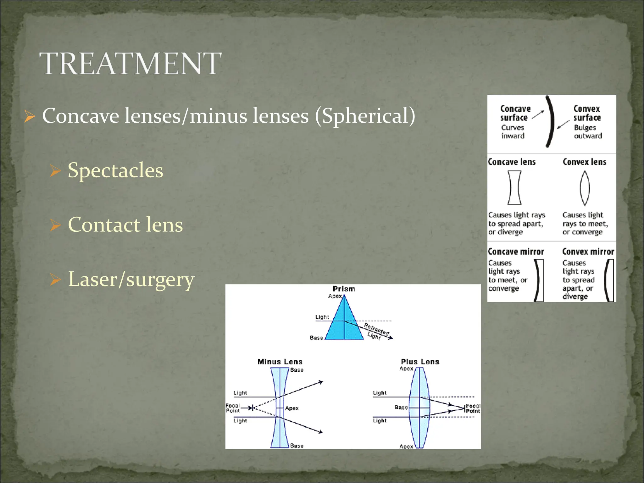  Concave lenses/minus lenses (Spherical)
 Spectacles
 Contact lens
 Laser/surgery
 