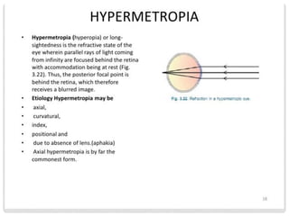 5 Refractive Errors and Visual acuity 2021.pdf