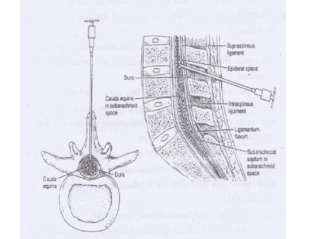 5 regional anesthesia