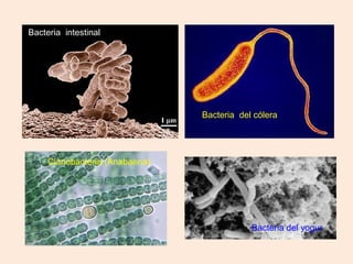 Bacteria intestinal
Bacteria del cólera
Bacteria del yogur
Cianobacteria (Anabaena)
 
