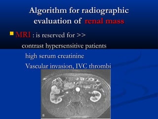 Algorithm for radiographicAlgorithm for radiographic
evaluation ofevaluation of renal massrenal mass
 MRIMRI : is reserved for >>: is reserved for >>
contrast hypersensitive patientscontrast hypersensitive patients
high serum creatininehigh serum creatinine
Vascular invasion, IVC thrombiVascular invasion, IVC thrombi
 