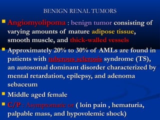 BENIGN RENAL TUMORSBENIGN RENAL TUMORS
 AngiomyolipomaAngiomyolipoma :: benign tumorbenign tumor consisting ofconsisting of
varying amounts of maturevarying amounts of mature adipose tissueadipose tissue,,
smooth muscle, andsmooth muscle, and thickthick--walled vesselswalled vessels
 Approximately 20% to 30% of AMLs are found inApproximately 20% to 30% of AMLs are found in
patients withpatients with tuberous sclerosistuberous sclerosis syndromesyndrome ((TSTS)),,
an autosomal dominant disorder characterized byan autosomal dominant disorder characterized by
mental retardation, epilepsy, and adenomamental retardation, epilepsy, and adenoma
sebaceumsebaceum
 Middle aged femaleMiddle aged female
 C/PC/P : Asymptomatic or: Asymptomatic or ( loin pain , hematuria,( loin pain , hematuria,
palpable mass, and hypovolemic shock)palpable mass, and hypovolemic shock)
 