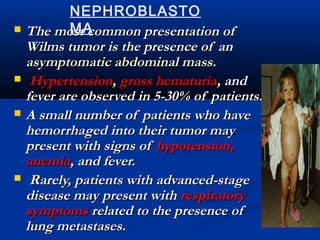  The most common presentation ofThe most common presentation of
Wilms tumor is the presence of anWilms tumor is the presence of an
asymptomatic abdominal mass.asymptomatic abdominal mass.
 HypertensionHypertension,, gross hematuriagross hematuria, and, and
fever are observed in 5-30% of patients.fever are observed in 5-30% of patients.
 A small number of patients who haveA small number of patients who have
hemorrhaged into their tumor mayhemorrhaged into their tumor may
present with signs ofpresent with signs of hypotension,hypotension,
anemiaanemia, and fever., and fever.
 Rarely, patients with advanced-stageRarely, patients with advanced-stage
disease may present withdisease may present with respiratoryrespiratory
symptomssymptoms related to the presence ofrelated to the presence of
lung metastases.lung metastases.
NEPHROBLASTO
MA
 