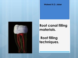 Waleed K.O. Jaber




Root canal filling
materials.

 Root filling
techniques.
 