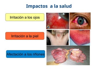 17/10/11
Irritación a los ojos
Irritación a la piel
Afectación a los riñones
Impactos a la salud
 