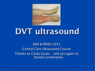 DVT ultrasound
           SAH & RNSH 2011
    Critical Care Ultrasound Course
Thanks to Cindy Lucas… and yet again to
             Daniel Lichtenstein


                                      1
 