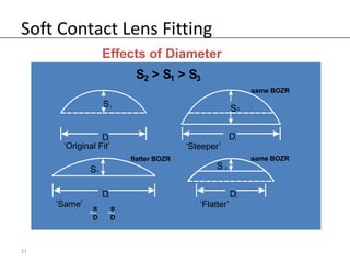 Soft Contact Lens Fitting
                       Effects of Diameter
                                     S2 > S1 > S3
                                                                           same BOZR

                       S   1
                                                                   S2


                       D
                       1
                                                                   D2


      ‘Original Fit’                               ‘Steeper’
                                    flatter BOZR                           same BOZR
              S   4
                                                           S   3




                       D
                       4                                           D   3


     ‘Same’                                           ‘Flatter’
              S11          S   44


              D   11       D   44




11
 