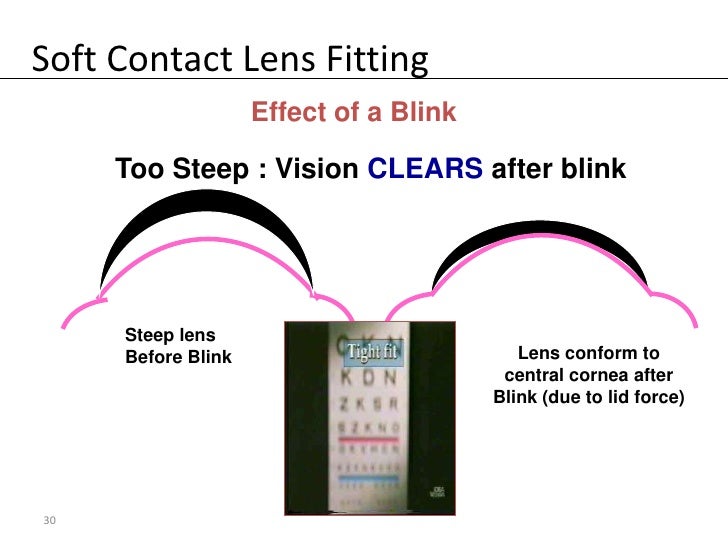Contact Lens Base Curve Chart