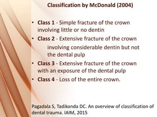 Classification by McDonald (2004)
• Class 1 - Simple fracture of the crown
involving little or no dentin
• Class 2 - Extensive fracture of the crown
involving considerable dentin but not
the dental pulp
• Class 3 - Extensive fracture of the crown
with an exposure of the dental pulp
• Class 4 - Loss of the entire crown.
Pagadala S, Tadikonda DC. An overview of classification of
dental trauma. IAIM, 2015
 