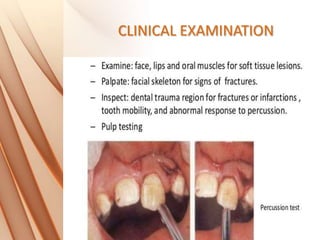 CLINICAL EXAMINATION
 