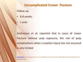 Uncomplicated Crown fracture
Follow-up
• 6-8 weeks.
• 1 year.
Andreasen et al, reported that in cases of crown
fracture without pulp exposure, the risk of pulp
complications when a luxation injury has not occurred
is very limited
Josué Martos et al ,Management of an uncomplicated crown fracture by reattaching the fractured fragment; 06
September 2017
 