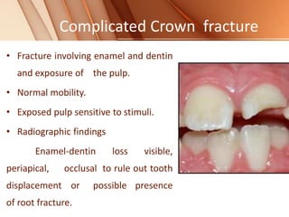 Complicated Crown fracture
• Fracture involving enamel and dentin
and exposure of the pulp.
• Normal mobility.
• Exposed pulp sensitive to stimuli.
• Radiographic findings
Enamel-dentin loss visible,
periapical, occlusal to rule out tooth
displacement or possible presence
of root fracture.
 