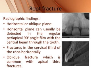 Root fracture
Radiographic findings:
• Horizontal or oblique plane:
• Horizontal plane can usually be
detected in the regular
periapical 90o angle film with the
central beam through the tooth.
• Fractures in the cervical third of
the root-horizontally
• Oblique fracture which is
common with apical third
fractures.
 
