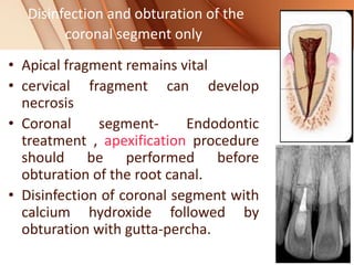 Disinfection and obturation of the
coronal segment only
• Apical fragment remains vital
• cervical fragment can develop
necrosis
• Coronal segment- Endodontic
treatment , apexification procedure
should be performed before
obturation of the root canal.
• Disinfection of coronal segment with
calcium hydroxide followed by
obturation with gutta-percha.
 