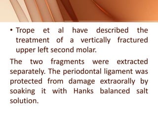 • Trope et al have described the
treatment of a vertically fractured
upper left second molar.
The two fragments were extracted
separately. The periodontal ligament was
protected from damage extraorally by
soaking it with Hanks balanced salt
solution.
 