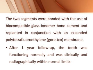 The two segments were bonded with the use of
biocompatible glass ionomer bone cement and
replanted in conjunction with an expanded
polytetrafluoroethylene (gore-tex) membrane.
• After 1 year follow-up, the tooth was
functioning normally and was clinically and
radiographically within normal limits
 