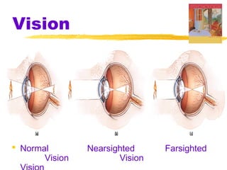 Vision
 Normal Nearsighted Farsighted
Vision Vision
 