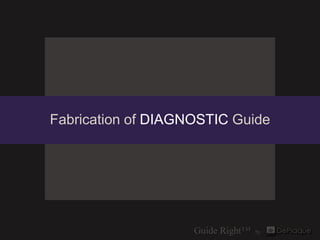 Fabrication of DIAGNOSTIC Guide
 