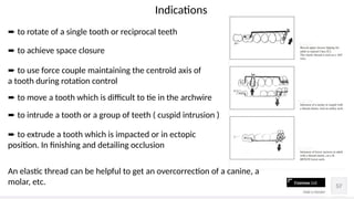 Reciprocal Tooth Comprehensive Orthodontic Space Closure Techniques and Biomechanics | PPTX