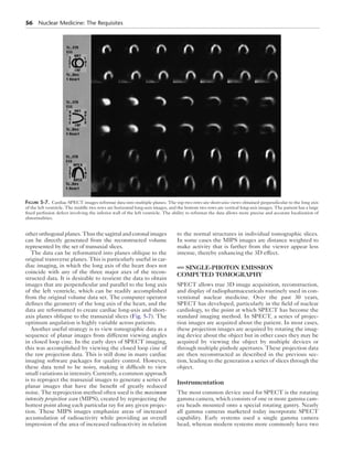 56 Nuclear Medicine: The Requisites 
Figure 5-7. Cardiac SPECT images reformat data into multiple planes. The top two rows are short-axis views obtained perpendicular to the long axis 
of the left ventricle. The middle two rows are horizontal long-axis images, and the bottom two rows are vertical long-axis images. The patient has a large 
fixed perfusion defect involving the inferior wall of the left ventricle. The ability to reformat the data allows more precise and accurate localization of 
abnormalities. 
other orthogonal planes. Thus the sagittal and coronal images 
can be directly generated from the reconstructed volume 
represented by the set of transaxial slices. 
The data can be reformatted into planes oblique to the 
original transverse planes. This is particularly useful in car-diac 
imaging, in which the long axis of the heart does not 
coincide with any of the three major axes of the recon-structed 
data. It is desirable to reorient the data to obtain 
images that are perpendicular and parallel to the long axis 
of the left ventricle, which can be readily accomplished 
from the original volume data set. The computer operator 
defines the geometry of the long axis of the heart, and the 
data are reformatted to create cardiac long-axis and short-axis 
planes oblique to the transaxial slices (Fig. 5-7). The 
optimum angulation is highly variable across patients. 
Another useful strategy is to view tomographic data as a 
sequence of planar images from different viewing angles 
in closed loop cine. In the early days of SPECT imaging, 
this was accomplished by viewing the closed loop cine of 
the raw projection data. This is still done in many cardiac 
imaging software packages for quality control. However, 
these data tend to be noisy, making it difficult to view 
small variations in intensity. Currently, a common approach 
is to reproject the transaxial images to generate a series of 
planar images that have the benefit of greatly reduced 
noise. The reprojection method often used is the maximum 
intensity projection scan (MIPS), created by reprojecting the 
hottest point along each particular ray for any given projec-tion. 
These MIPS images emphasize areas of increased 
accumulation of radioactivity while providing an overall 
impression of the area of increased radioactivity in relation 
to the normal structures in individual tomographic slices. 
In some cases the MIPS images are distance weighted to 
make activity that is farther from the viewer appear less 
intense, thereby enhancing the 3D effect. 
SINGLE-PHOTON EMISSION 
COMPUTED TOMOGRAPHY 
SPECT allows true 3D image acquisition, reconstruction, 
and display of radiopharmaceuticals routinely used in con-ventional 
nuclear medicine. Over the past 30 years, 
SPECT has developed, particularly in the field of nuclear 
cardiology, to the point at which SPECT has become the 
standard imaging method. In SPECT, a series of projec-tion 
images are acquired about the patient. In most cases, 
these projection images are acquired by rotating the imag-ing 
device about the object but in other cases they may be 
acquired by viewing the object by multiple devices or 
through multiple pinhole apertures. These projection data 
are then reconstructed as described in the previous sec-tion, 
leading to the generation a series of slices through the 
object. 
Instrumentation 
The most common device used for SPECT is the rotating 
gamma camera, which consists of one or more gamma cam-era 
heads mounted onto a special rotating gantry. Nearly 
all gamma cameras marketed today incorporate SPECT 
capability. Early systems used a single gamma camera 
head, whereas modern systems more commonly have two 
 