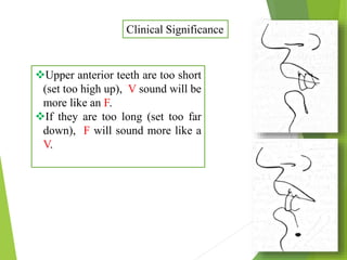 Upper anterior teeth are too short
(set too high up), V sound will be
more like an F.
If they are too long (set too far
down), F will sound more like a
V.
Clinical Significance
 