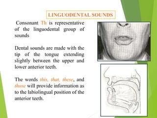 LINGUODENTAL SOUNDS
Consonant Th is representative
of the linguodental group of
sounds
Dental sounds are made with the
tip of the tongue extending
slightly between the upper and
lower anterior teeth.
The words this, that, these, and
those will provide information as
to the labiolingual position of the
anterior teeth.
 