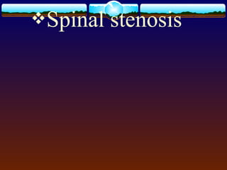 Spinal stenosis
 