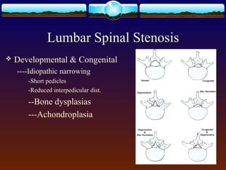 Lumbar Spinal Stenosis
 Developmental & Congenital
----Idiopathic narrowing
-Short pedicles
-Reduced interpedicular dist.
--Bone dysplasias
---Achondroplasia
 