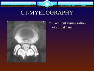  Excellent visualization
of spinal canal
CT-MYELOGRAPHY
 