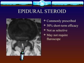 EPIDURAL STEROID
 Commonly prescribed
 50% short-term efficacy
 Not as selective
 May not require
fluroscope
 