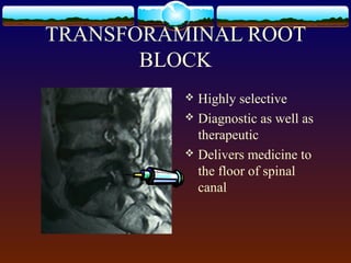 TRANSFORAMINAL ROOT
BLOCK
 Highly selective
 Diagnostic as well as
therapeutic
 Delivers medicine to
the floor of spinal
canal
 