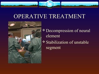 OPERATIVE TREATMENT
 Decompression of neural
element
 Stabilization of unstable
segment
 