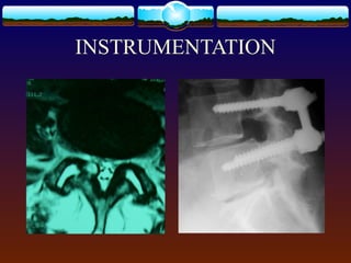 INSTRUMENTATION
 