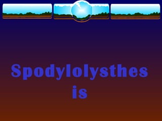 Spodylolysthes
is
 