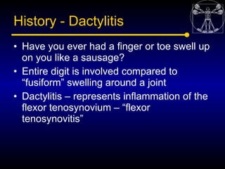 History - Dactylitis
• Have you ever had a finger or toe swell up
  on you like a sausage?
• Entire digit is involved comp...