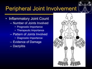 Peripheral Joint Involvement
• Inflammatory Joint Count
  – Number of Joints Involved
     • Prognostic Importance
     • ...