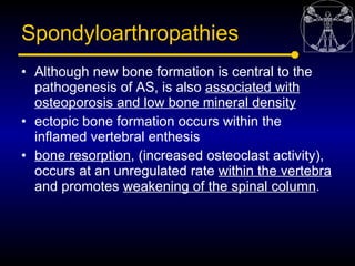 Spondyloarthropathies
• Although new bone formation is central to the
  pathogenesis of AS, is also associated with
  oste...