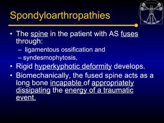 Spondyloarthropathies
• The spine in the patient with AS fuses
  through:
  – ligamentous ossification and
  – syndesmophy...