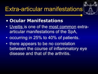 Extra-articular manifestations
• Ocular Manifestations
• Uveitis is one of the most common extra-
  articular manifestatio...
