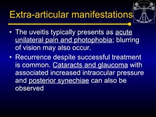 Extra-articular manifestations
• The uveitis typically presents as acute
  unilateral pain and photophobia; blurring
  of ...