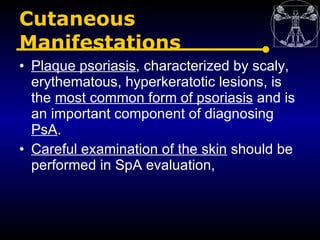 Cutaneous
Manifestations
• Plaque psoriasis, characterized by scaly,
  erythematous, hyperkeratotic lesions, is
  the most...