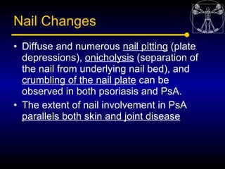 Nail Changes
• Diffuse and numerous nail pitting (plate
  depressions), onicholysis (separation of
  the nail from underly...